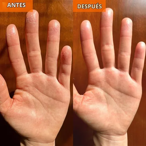 Vista 7 de Yu-Be Crema hidratante para la piel (individual) – Crema hidratante para la noche y el día Hidratante calmante para piel seca Seguro