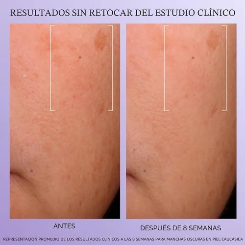 Vista 4 de Lancôme Rénergie H.C.F. Triple Serum - Suero de ácido hialurónico para corrección visible de signos antienvejecimiento y manchas oscuras - Con