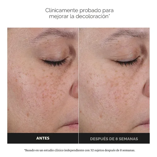 Vista 2 de Paula's Choice Suero con 25% de vitamina C con glutatión y antioxidantes, el suero facial mejora la decoloración, el tono desigual y reafirma, todo