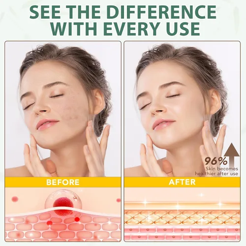 Vista 3 de ReliCo Sarga de ternera batida para la piel humectante facial – Sarga de res orgánica alimentada con pasto batido con crema de miel para el cuerpo