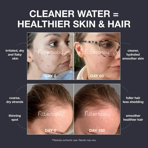 Vista 3 de Filterbaby Filtro de ducha de diamante, certificado IAPMO según el estándar NSF177, filtro desarrollado por expertos para piel y cabello, probado