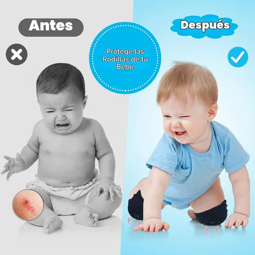 Vista 4 de Almohadillas antideslizantes para gatear para bebés, protegen la rodilla del bebé para gatear