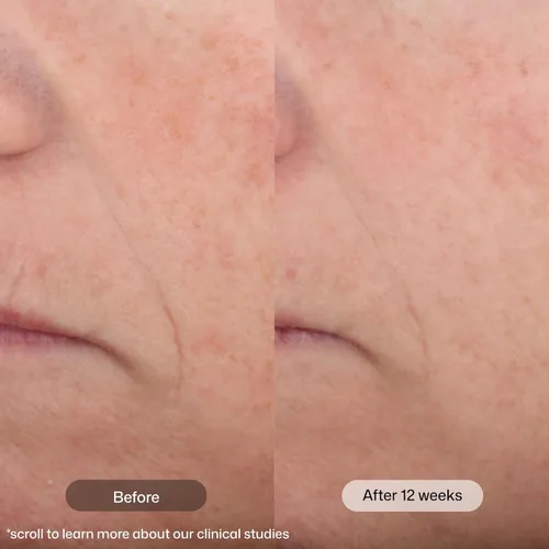 Vista 3 de Revision Skincare Intellishade Mate 5 en 1 crema hidratante teñida antienvejecimiento con SPF 45, corrige, protege, oculta, ilumina e hidrata