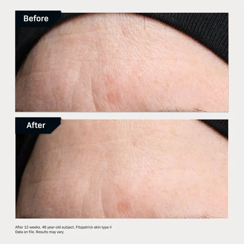 Vista 6 de Revision Skincare Revox™ Line Relaxer, un suero avanzado y dirigido para mejorar la apariencia de líneas y arrugas debajo de los ojos con ácido