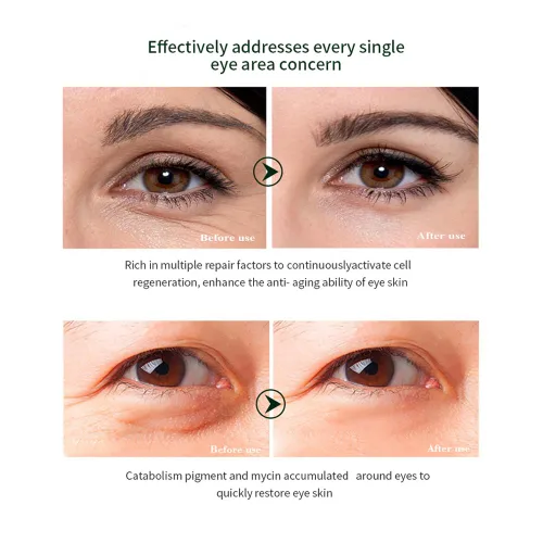 Vista 2 de DISAAR Beauty Crema de ojos con extracto de caracol de colágeno, antiarrugas, ojeras, bolsas para los ojos y tratamiento antienvejecimiento