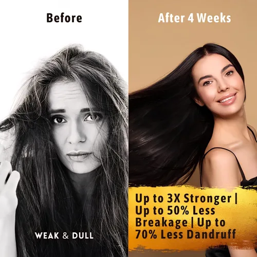 Vista 7 de Suero para el crecimiento del cabello para mujeres y hombres — USDA Organic, 10 en 1 Tricho10™ suero para el cuero cabelludo para un cabello más