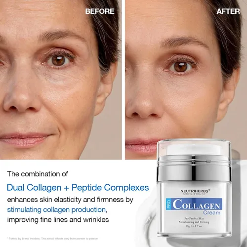 Vista 9 de Neutriherbs Crema facial hidratante facial de colágeno, reduce las manchas negras y las imperfecciones, la hidratación persistente reduce las líneas