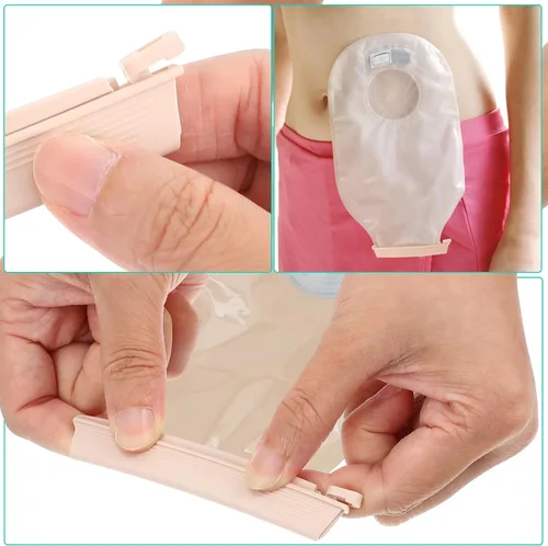 Vista 5 de 10 clips para bolsas de ostomía, abrazaderas de bolsa drenables a prueba de fugas, clip de sellado de cierre de cola reutilizable, suministros