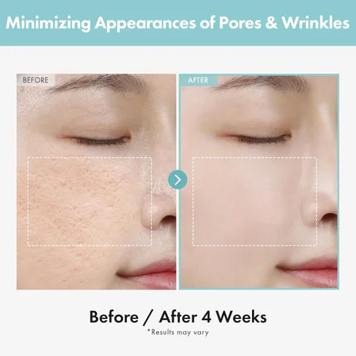 Vista 3 de TOSOWOONG Crema Refinadora de Poros, Minimizador de Poros con AHA - Ácido Glicólico y Ácido Láctico, Hidratante Facial para Control de Grasa