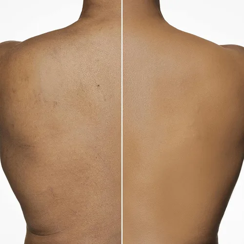 Vista 7 de Dermablend Leg and Body Makeup Foundation with SPF 25