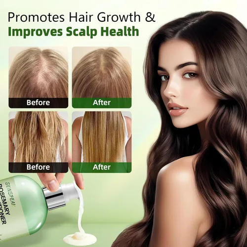 Vista 2 de Acondicionador de romero para el crecimiento del cabello: acondicionador hidratante espesante para hombres y mujeres con aceite de árbol de té