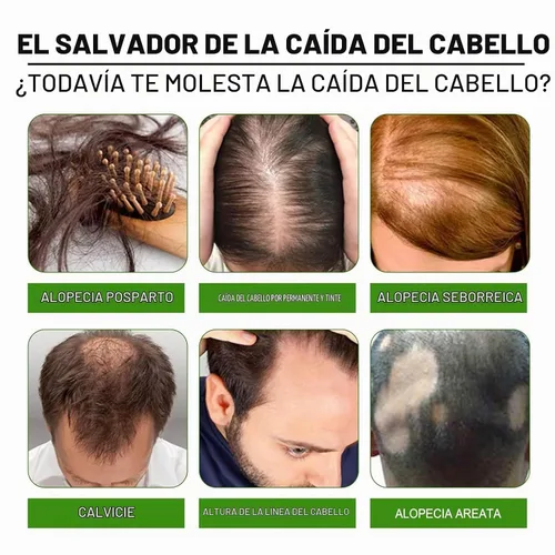 Vista 5 de Sistema de crecimiento del cabello - Tratamiento avanzado para el crecimiento del cabello con ginseng, Eclipta Prostrata, aceite de menta y raíz