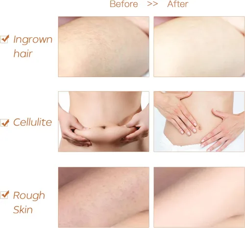Vista 7 de ICANdOIT Cepillo corporal muy rígido para hombres y mujeres, cepillo de piel seca de mango largo para celulitis y drenaje linfático con cerdas
