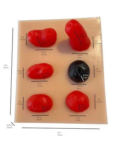 Vista 2 de Juego de modelos de estoma de silicona para simulación, práctica de cuidado de ostomía, demostración, 6 estomas