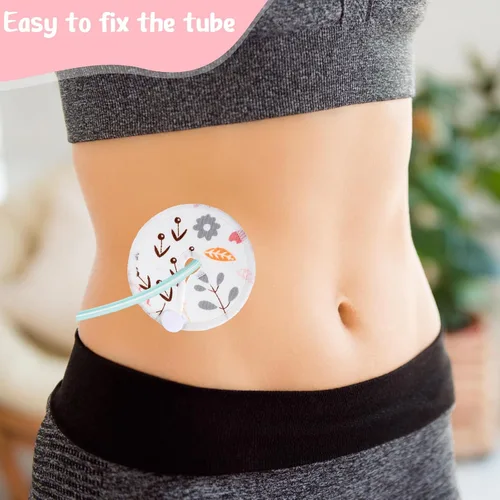 Vista 5 de Yungyan 24 fundas para tubos G, almohadillas reutilizables para botones de alimentación, fundas suaves para botones de tubo G J, almohadillas