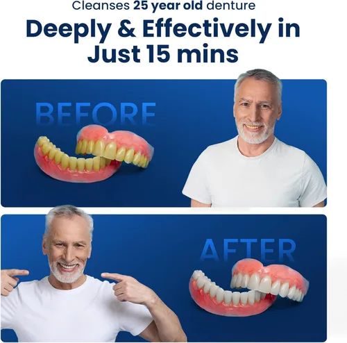 Vista 15 de iSonic Limpiador ultrasónico de dentadura/alineador/retenedor para todos los aparatos dentales y de la apnea del sueño (F3900)