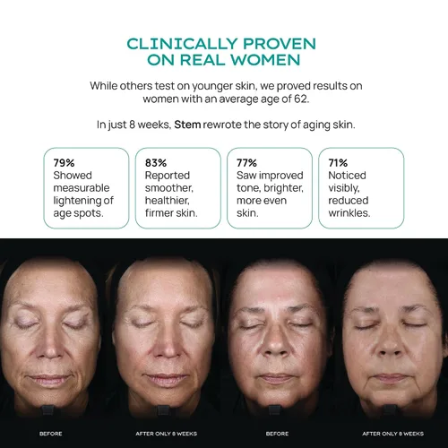 Vista 5 de ReVitalize - Crema hidratante facial antienvejecimiento con niacinamida, bakuchiol y péptidos, suero hidratante facial restaurador de la piel