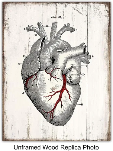 Vista 2 de Medical Anatomy – Juego de placas de arte de pared de órganos humanos vintage – Impresiones de fotos Shabby Chic para clínica médica, oficina de Dr.