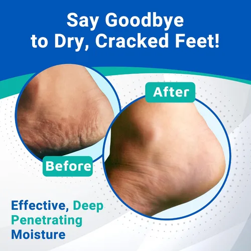Vista 5 de Crema para talones Dermal Therapy, 3 onzas