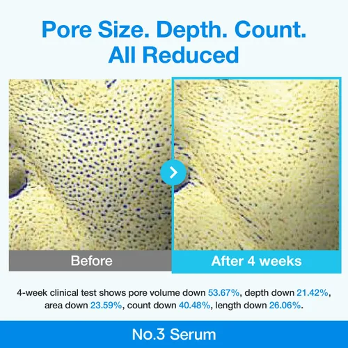 Vista 3 de numbuzin Suero de retinol No.3 Suero de refinación de poros azul bio-retinol Retinol principiante, apriete, reafirmante, BHA, niacinamida