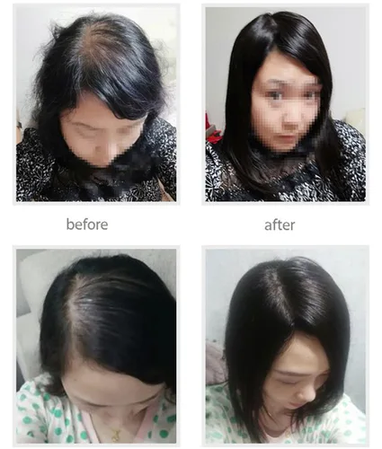 Vista 7 de 2 x 3 pulgadas, mono, lacio, cabello humano virgen con clip, pieza de pelo para mujer (6 pulgadas, marrón oscuro)