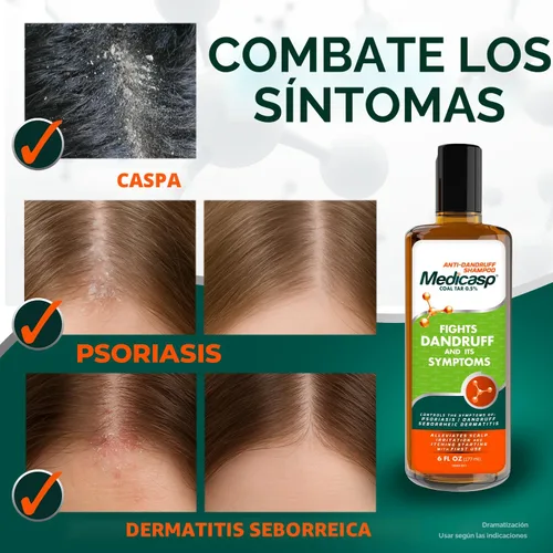 Vista 4 de MEDICASP Shampoo anticaspa con alquitrán de hulla, Trata la caspa, dermatitis seborreica y psoriasis, 6 onzas líquidas Alleviates Symptoms from