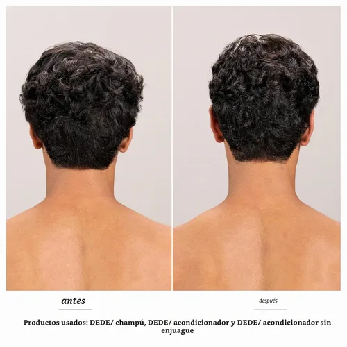 Vista 2 de Davines DEDE/Conditioner, Daily Lightweight Detangling Formula for Fine & Medium Hair - Gentle Mineral-Rich Moisturizing Treatment with Red Celery