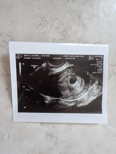 Vista 3 de Broma de ultrasonido falso personalizado 2D, foto única SOLO, SIN género