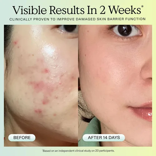 Vista 5 de KraveBeauty Great Barrier Relief Serum - Suero reparador de barrera inspirado en Corea, aceite de tamanu, alivia el enrojecimiento e hidrata, vegano