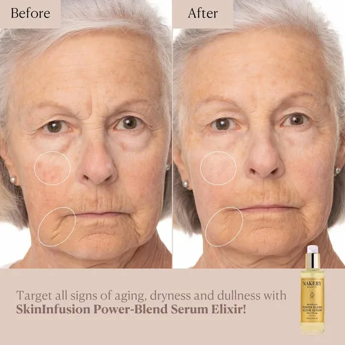 Vista 3 de Nakery SkinInfusion - Suero de aceite facial (5.07 onzas líquidas), suero de colágeno antienvejecimiento con ácido hialurónico, matrixyl 3000