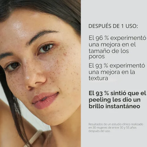 Vista 3 de SHANI DARDEN SKIN CARE Exfoliante Triple Ácido, Exfoliante Facial de 2 Pasos con Ácidos Mandélico, Láctico y Glicólico, Mascarilla Neutralizante