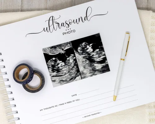 Vista 14 de Personalized Twin Pregnancy Journal (8 Center Designs) - Hardcover Pregnancy Memory Book Customized with Babies’ Names, Nicknames or Phrase