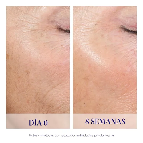 Vista 4 de iS CLINICAL Active Peel System, sistema de peeling suave en casa de dos pasos para exfoliación facial