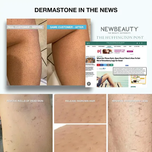 Vista 7 de Exfoliante para piernas y cuerpo: exfoliante profundo para el tratamiento de piernas de fresa, exfoliante de piernas encarnadas, removedor de piel