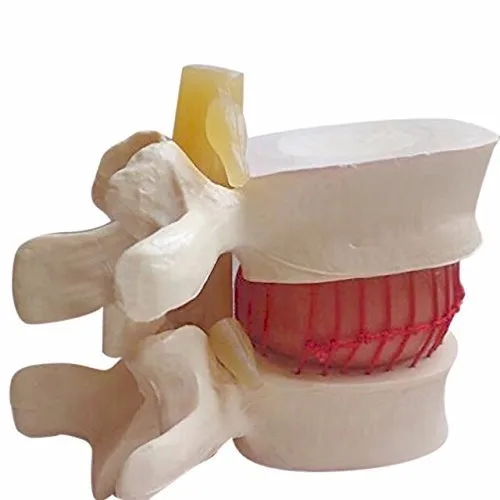 Vista 5 de DENTAL Color blanco oral 1:1.5 vértebras lumbares humanas anatómicas degenerativas lumbares modelo de columna vertebral humana US Stock