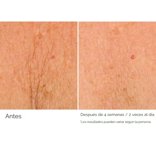 Vista 5 de NassifMD Deco-Lift Neck & Decollete Firming & Lifting Complex