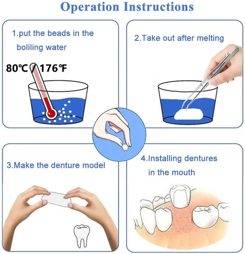 Vista 5 de Kit de reparación de dientes: cuentas térmicas para rellenar arreglar el diente faltante y roto o adhesivo de dientes falsos de la dentadura