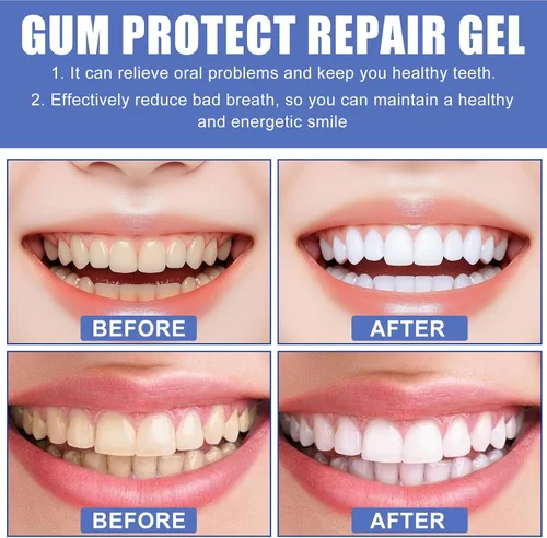 Vista 6 de 3PCS Gum Protect Dental Gel, solución profesional para la salud de las encías