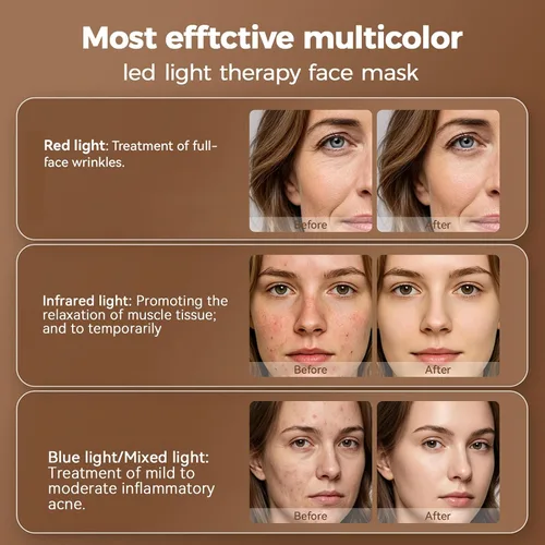 Vista 9 de Terapia de luz roja para cara, terapia de luz de máscara facial LED