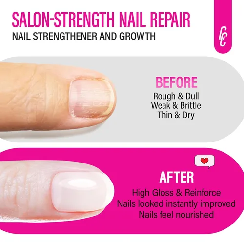 Vista 6 de CHUCHU Fortalecedor de uñas y reparación para mujeres: endurecedor extra fuerte blanco lechoso y tratamiento de crecimiento para pelar uñas finas