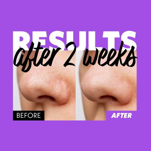 Vista 5 de Nosca9 - Espuma limpiadora profunda de poros para pieles sensibles, lavado facial coreano para el cuidado de la piel con 17 aminoácidos, arcilla