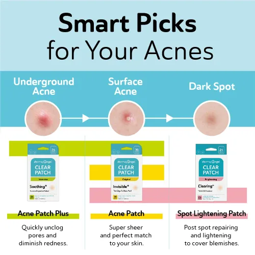 Vista 7 de DERMA ANGEL Parches grandes para espinillas para nariz, mentón y frente, poros de brotes y tratamiento de manchas, parches para acné hidrocoloide