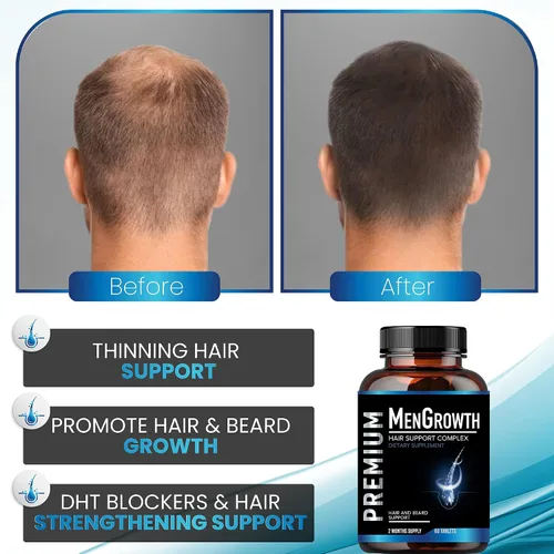 Vista 8 de NutraPro Vitaminas para el crecimiento del cabello para hombres, suplemento anti pérdida de cabello.