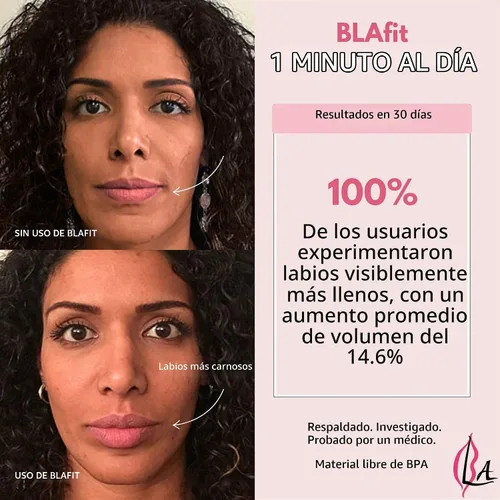 Vista 3 de Dispositivo de relleno de labios Dispositivo de relleno de labios no invasivo, sin dolor, ejercicio diario de 60 segundos para labios más llenos