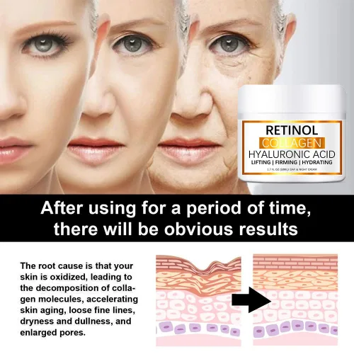 Vista 2 de Crema para Manchas Oscuras en La Cara, Crema para Arrugas, 1.76 oz de proteína de colágeno retinol y ácido hialurónico Crema hidratante facial