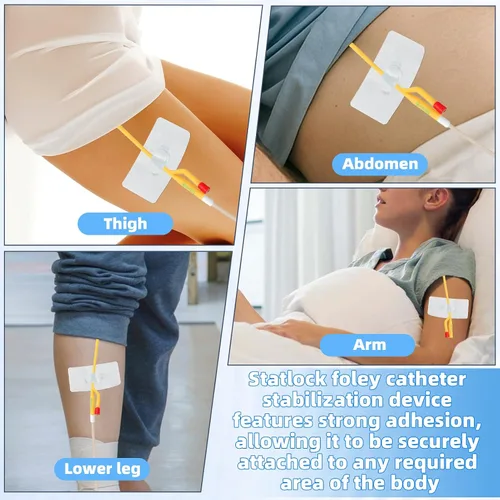 Vista 5 de Paquete de 5 dispositivos de estabilización de catéter Foley, soporte de catéter Foley de silicona, clip de suministros de catéter con anclaje