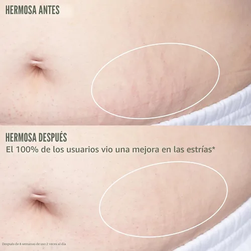 Vista 6 de Sol de Janeiro Aceite corporal Bum Bum Firmeza - Aceite de estrías