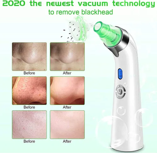 Vista 4 de DULASP Limpiador de poros al vacío para eliminar puntos negros, limpiador de poros faciales, kit eléctrico de extracción de acné y comedona
