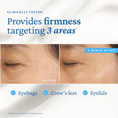 Vista 4 de belif Bomba de ojos con péptido, crema de ojos antienvejecimiento para arrugas, líneas finas, patas de gallo y bolsas de ojos, hidratación de 48