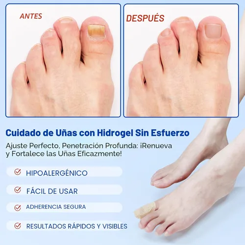 Vista 5 de Parches de uñas: 21 parches de reparación extra fuertes para uñas de los pies y uñas dañadas, cuidado de uñas durante la noche de 8 horas